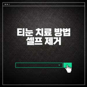 티눈 치료 방법 셀프